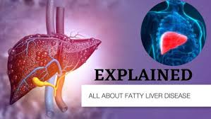 5 Jaw-Dropping Truths About Life Expectancy & Fatty Liver