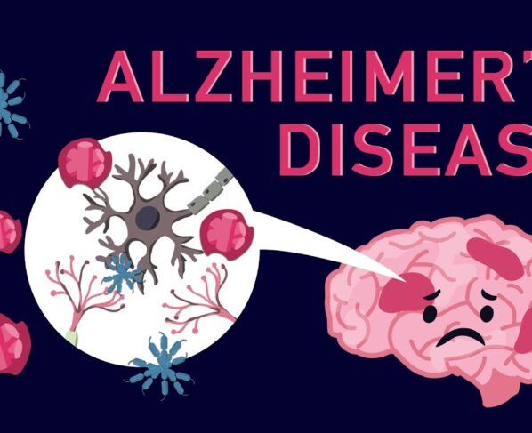 Memory Lost: Understanding the Warning Signs of Alzheimer's Disease