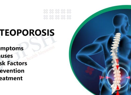 7 Risk Factors for Osteoporosis: Protecting Your Bones