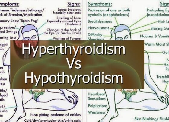 Hyper vs Hypo Thyroidism."