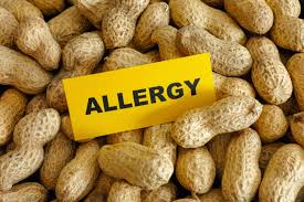 peanut-allergy-symptoms-management-prevention